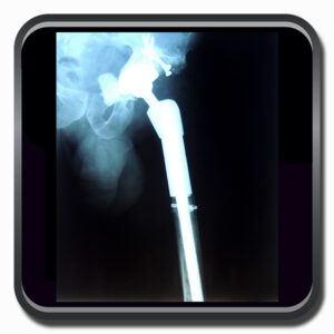 centro de ortopedia e fisioterapia Batel - Cofib - Cirurgias Complexas Sistema Locomotor