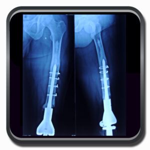 centro de ortopedia e fisioterapia Batel - Cofib - Cirurgias Complexas Sistema Locomotor