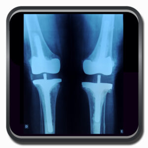 centro de ortopedia e fisioterapia Batel - Cofib - Cirurgias Complexas Sistema Locomotor