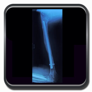 centro de ortopedia e fisioterapia Batel - Cofib - Cirurgias Complexas Sistema Locomotor