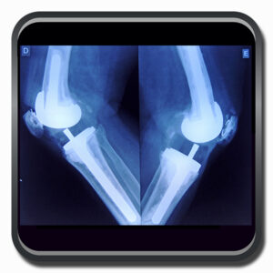 centro de ortopedia e fisioterapia Batel - Cofib - Cirurgias Complexas Sistema Locomotor