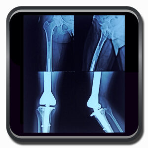 centro de ortopedia e fisioterapia Batel - Cofib - Cirurgias Complexas Sistema Locomotor