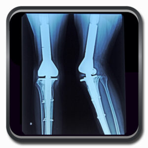 centro de ortopedia e fisioterapia Batel - Cofib - Cirurgias Complexas Sistema Locomotor