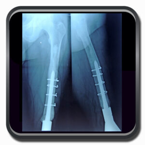 centro de ortopedia e fisioterapia Batel - Cofib - Cirurgias Complexas Sistema Locomotor