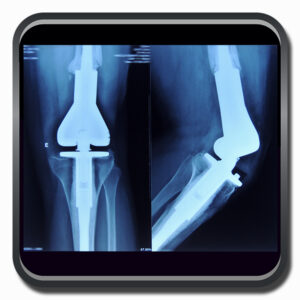 centro de ortopedia e fisioterapia Batel - Cofib - Cirurgias Complexas Sistema Locomotor