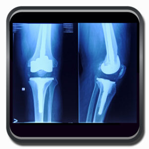 centro de ortopedia e fisioterapia Batel - Cofib - Cirurgias Complexas Sistema Locomotor