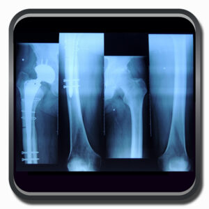 centro de ortopedia e fisioterapia Batel - Cofib - Cirurgias Complexas Sistema Locomotor