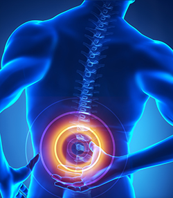 Centro de Ortopedia e Fisioterapia Batel - COFIB - Dor nas Costas