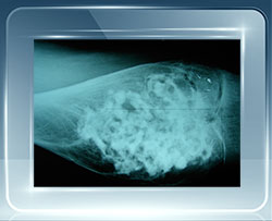 Clinica Cofib Tumores